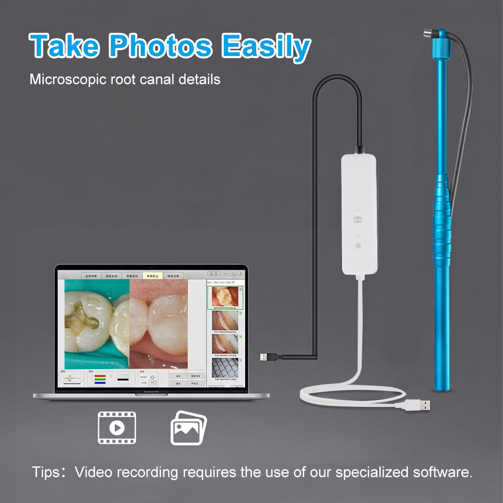 5MP Micro Intraoral Camera Den - đánh giá và giá Mini Pc Windows